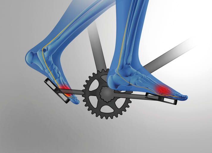   Die Füße werden oft unterschätzt, sind aber eine entscheidende Verbindungsstelle zwischen der Mensch-Maschine zum Antrieb des Rades.  Eine Fehlstellung der Füße auf dem Pedal führt vor allem auf längeren Strecken zu Kribbeln und Schmerzen 